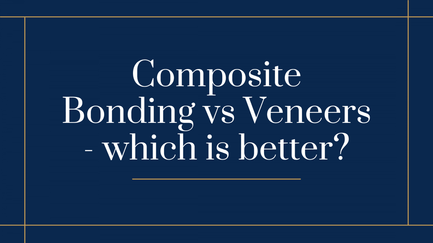 composite bonding vs veneers
