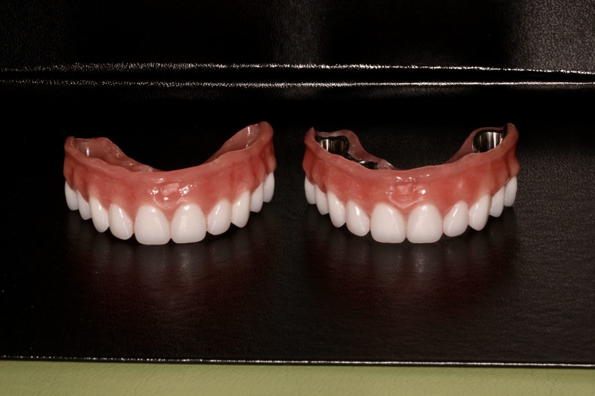 dentures for full set of teeth