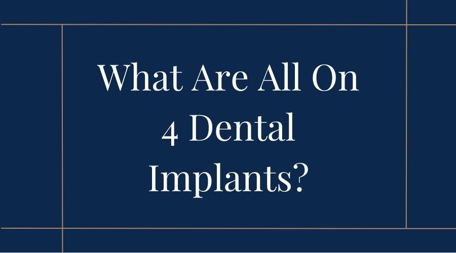 what are all on 4 dental implants?